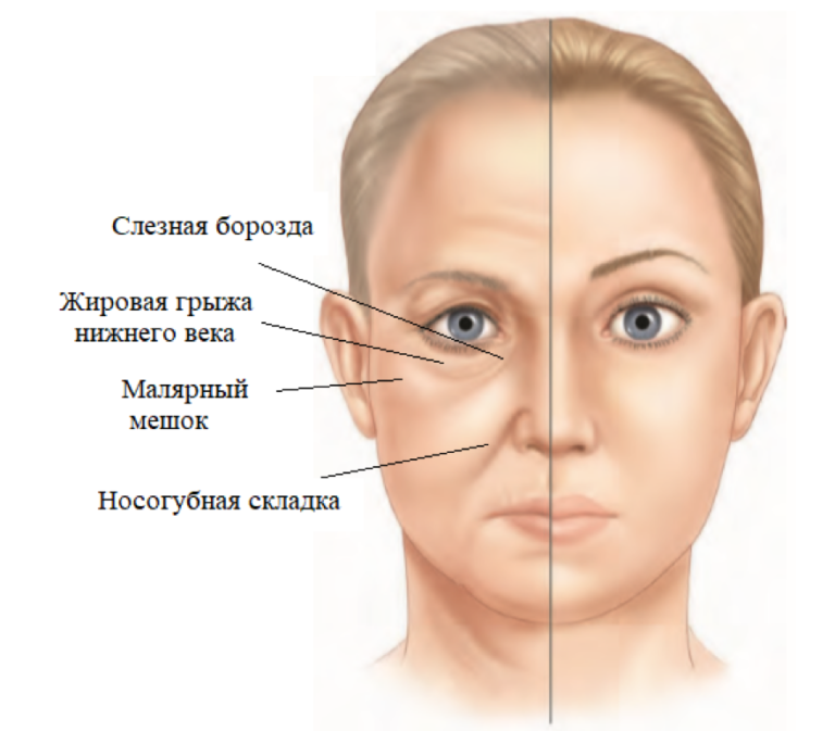Зоны лица в косметологии названия и фото